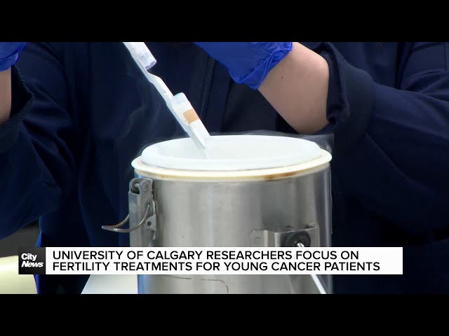 ⁣UCalgary researchers focus on fertility treatments for young cancer patients