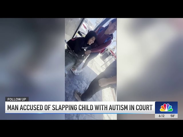 ⁣Man accused of slapping boy with autism in Pacoima seeks diversion