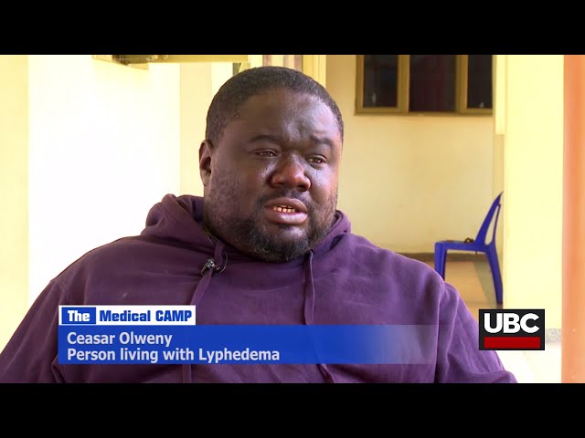 LYMPHEDEMA CEASAR OLWENY'S STORY