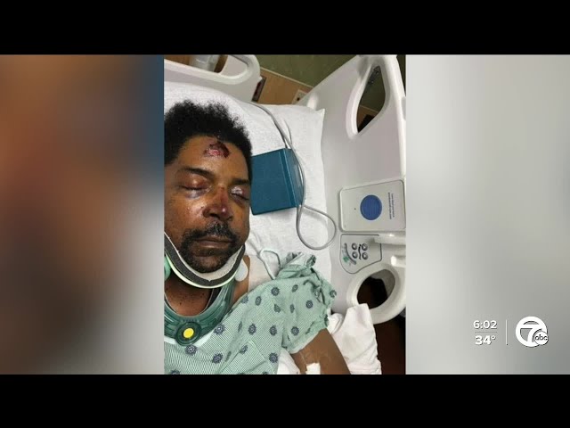 ⁣Daughter of a man assaulted outside Detroit Coney Island shares chilling details