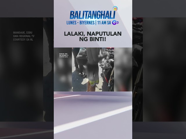 ⁣Lalaki, naputulan ng binti matapos mahagip ng isang motorsiklo #shorts | Balitanghali