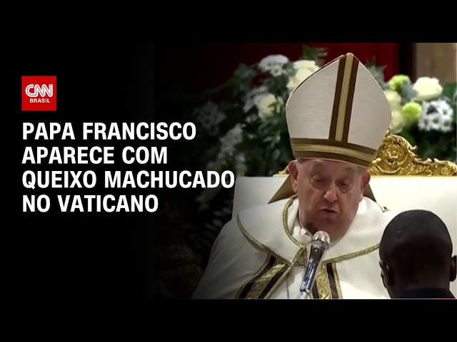 ⁣Papa Francisco aparece com queixo machucado no vaticano | AGORA CNN