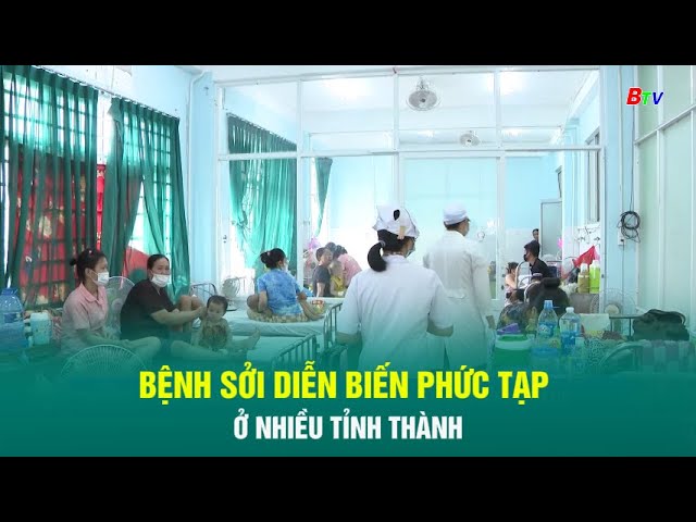 ⁣Bệnh sởi diễn biến phức tạp ở nhiều tỉnh thành