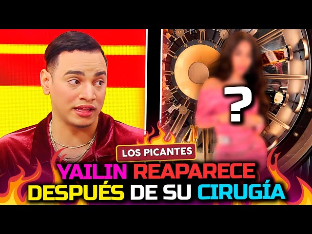 ⁣Yailin La Más Viral reaparece después de su cirugía: ¿Qué se hizo ahora?  | Vive el Espectáculo