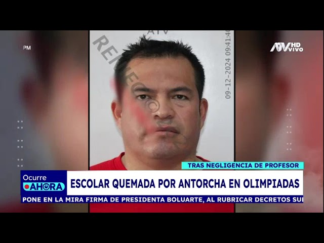 ⁣SJL: Escolar es quemada por antorcha durante olimpiadas por negligencia de profesor