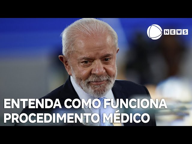 ⁣Internação de Lula: entenda como funciona procedimento para tratar hematoma