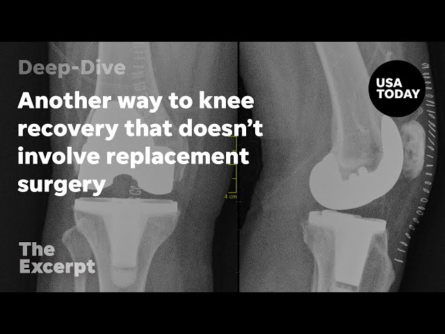 ⁣Another way to knee recovery that doesn't involve replacement surgery | The Excerpt