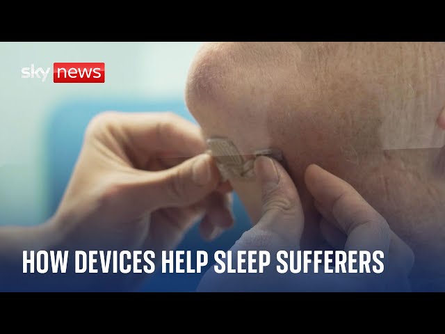 ⁣How electronic chips are helping obstructive sleep apnoea sufferers