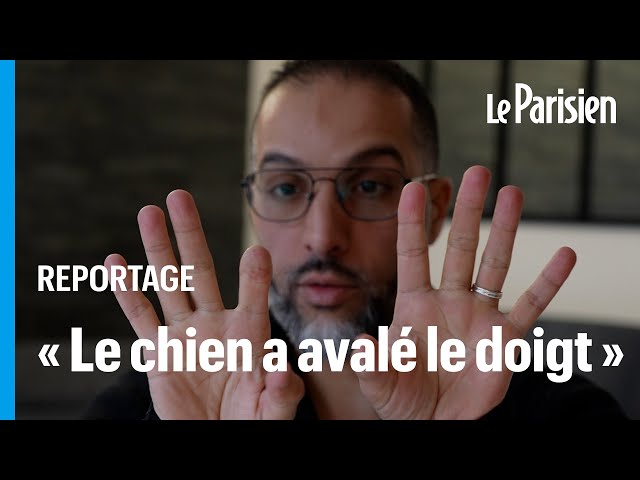 ⁣Abderrahmane veut déménager après avoir été mutilé par le chien de ses voisins