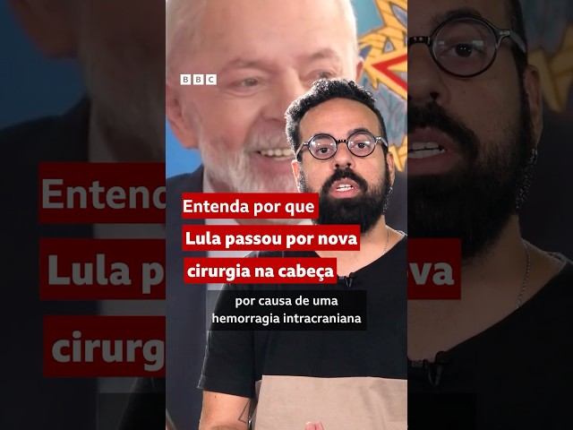 ⁣Lula: por que presidente precisou fazer uma segunda cirurgia na cabeça #bbcnewsbrasil