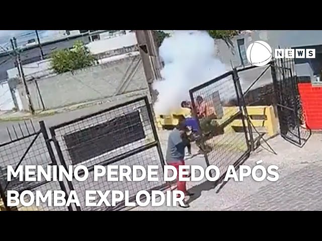 ⁣Menino perde dedo após explodir na frente de CT do Sport Club do Recife