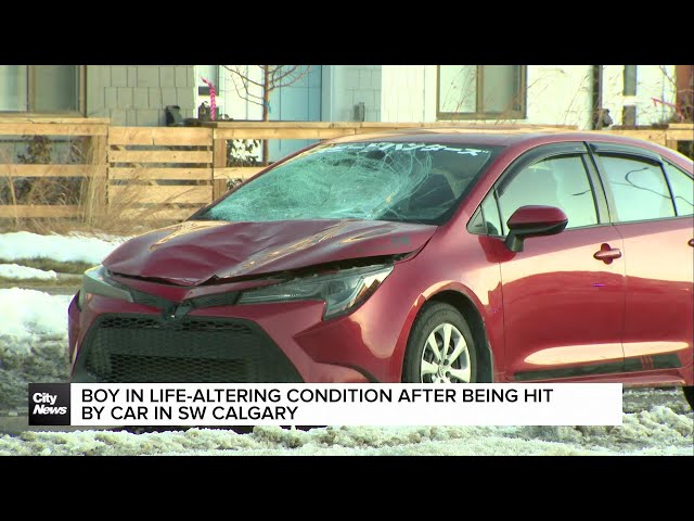 ⁣Boy in life-altering condition after being hit by car in SW Calgary