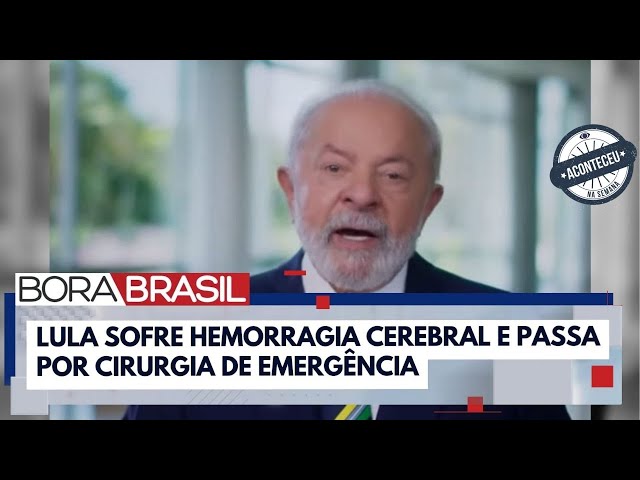 ⁣Aconteceu na Semana | As pesquisas dos brasileiros sobre hemorragia cerebral após cirurgia de Lula