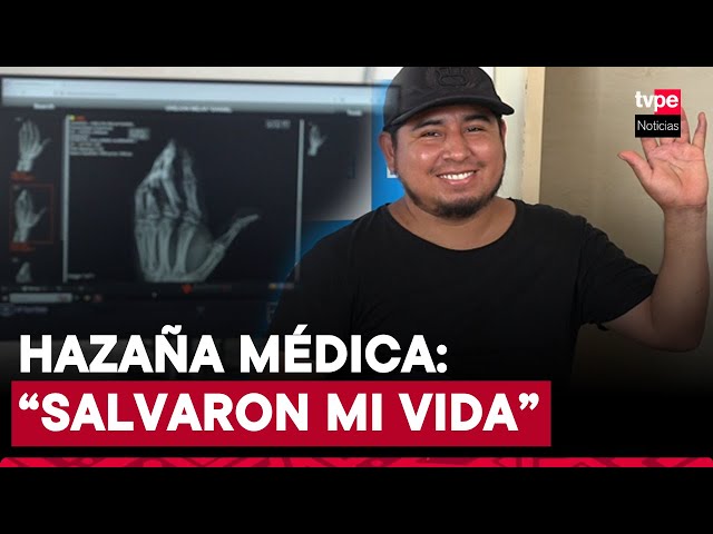 ⁣Milagro médico: reimplante exitoso de tres dedos salva la mano de un mecánico tras grave accidente