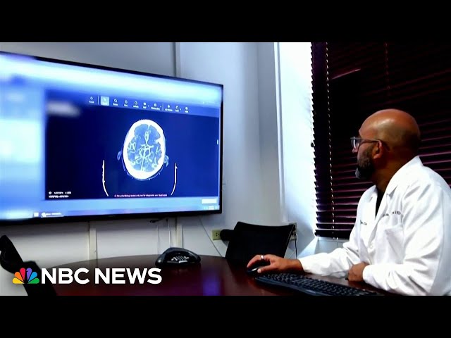 ⁣Doctors seek help from AI in medical diagnosis