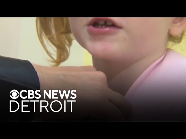 ⁣Michigan sees rise in whooping cough cases. What to know.