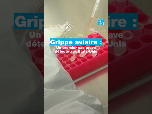 ⁣Grippe aviaire : un premier cas grave détecté aux États-Unis • FRANCE 24