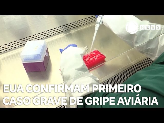 ⁣EUA confirmam primeiro caso grave de gripe aviária em humano