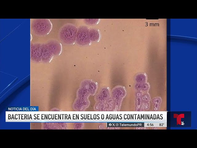 ⁣Peligrosa infección: en alerta el Departamento de Salud por melioidosis