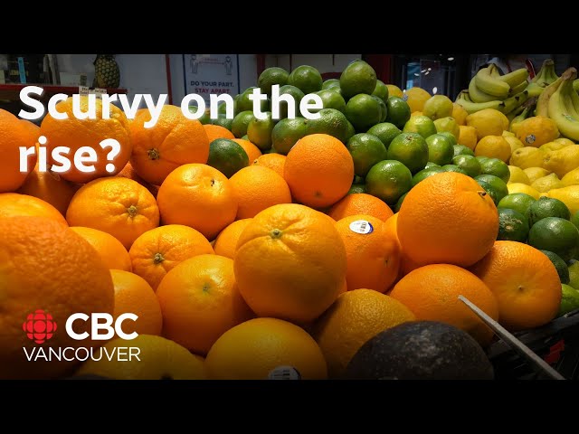 ⁣Nearly 700 people in B.C. reported to have a vitamin C deficiency