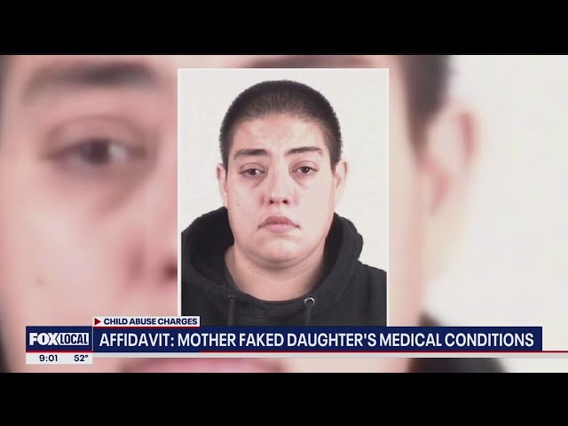 ⁣Texas woman faked daughter's medical conditions, led to unnecessary procedures:  report