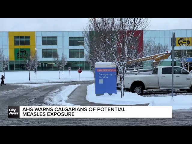 ⁣Confirmed measles case was in public in Calgary while infectious: AHS