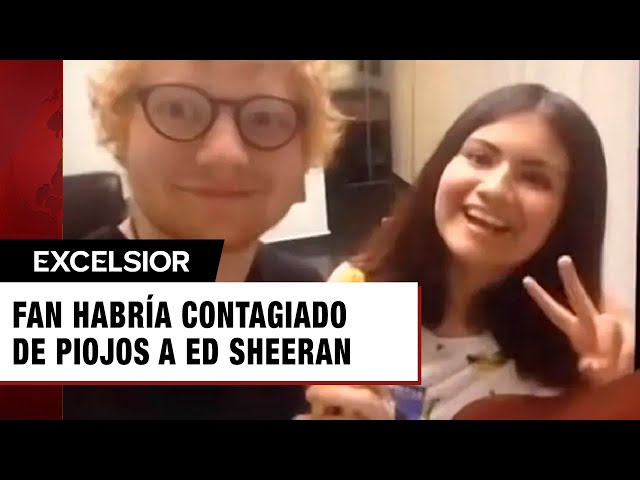 ⁣¡Experiencia inolvidable! Joven revela cómo le habría pegado los piojos a Ed Sheeran al conocerlo