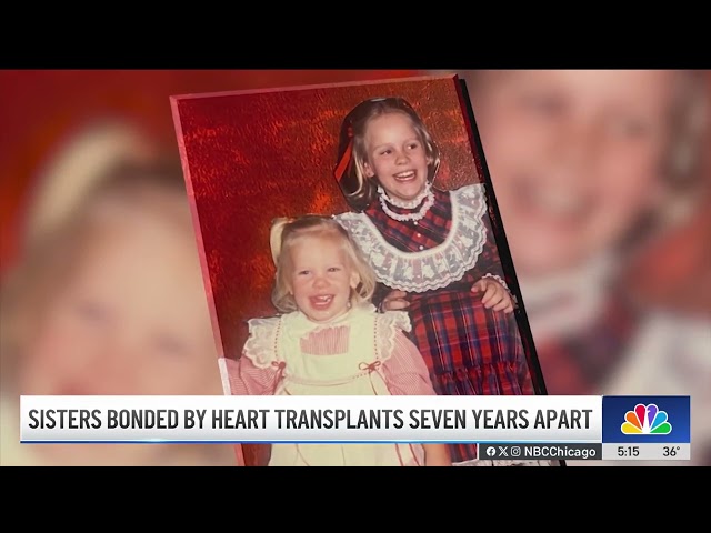 ⁣7 years apart, sisters celebrate successful heart transplants