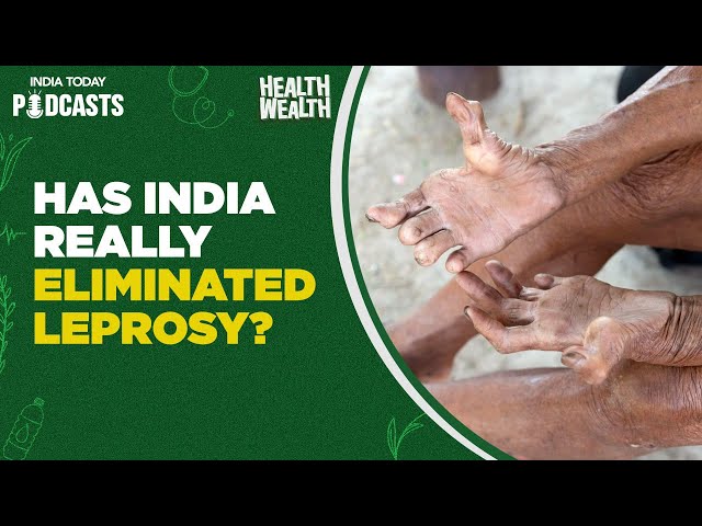 ⁣What is a leprosy community? | Health Wealth, Ep 75 | Health Podcasts