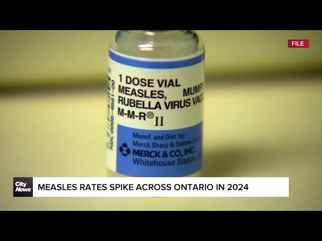 ⁣Measles cases on the rise in 2024