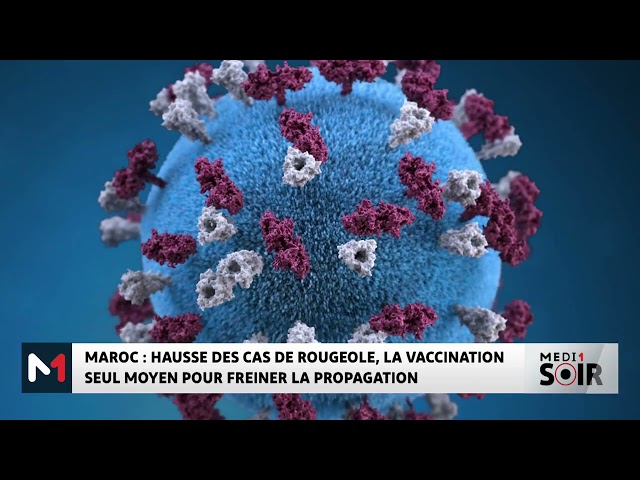 ⁣Hausse des cas de rougeole, la vaccination seul moyen pour freiner la propagation