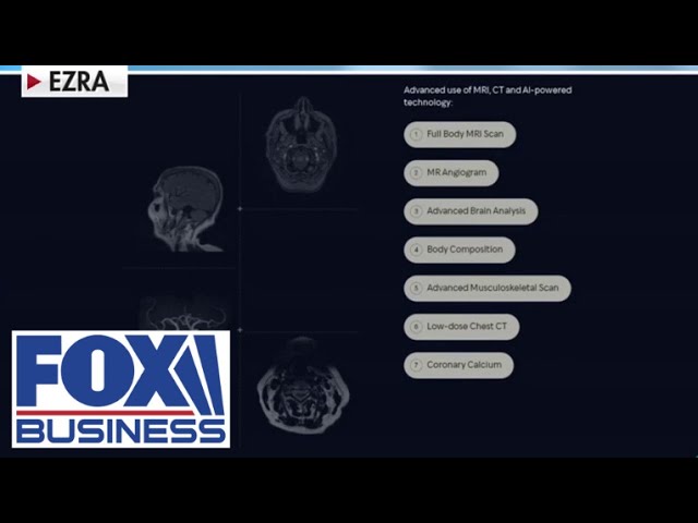 ⁣This AI scan identifies cancer and heart disease