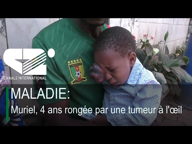 ⁣MALADIE: Muriel, 4 ans rongée par une tumeur à l'œil