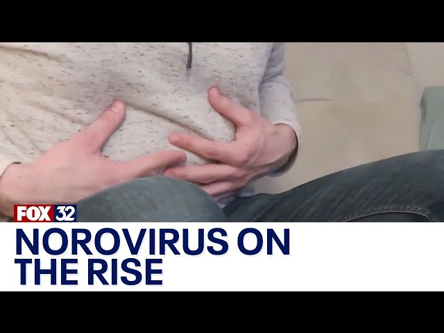 ⁣Norovirus on the rise, what to know