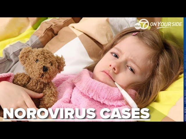 ⁣Norovirus cases on the rise: what to know about the virus