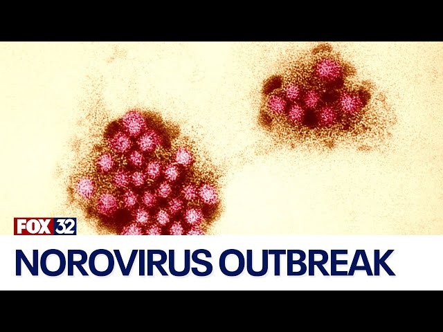 ⁣How to protect yourself from norovirus this winter season