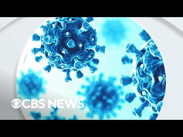 ⁣What to know about norovirus as cases surge across U.S.