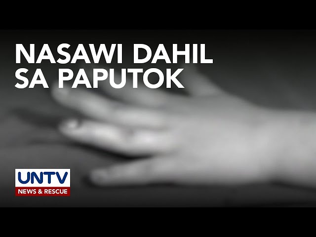 ⁣Mga biktima ng paputok, nasa 534 na; confirmed fatality dahil sa paputok, isa—DOH