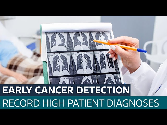 ⁣More cancer patients than ever in England are being diagnosed at early stage | ITV News