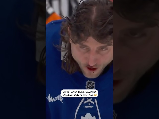 ⁣Chris Tanev Takes A Puck To The Face 