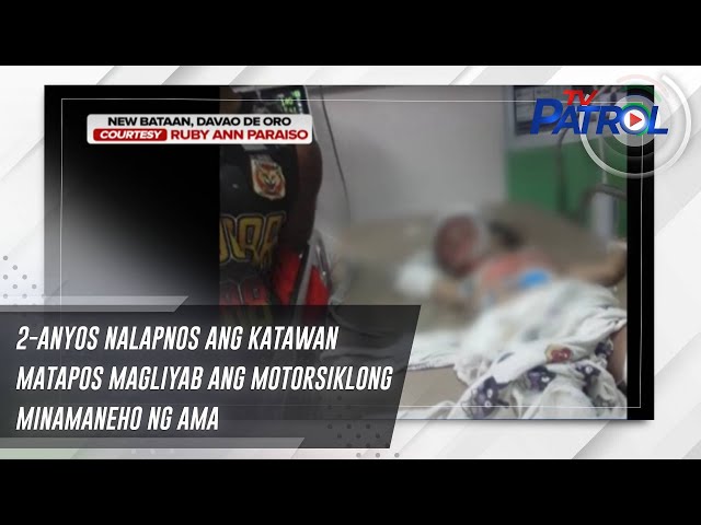 ⁣2-anyos nalapnos ang katawan matapos magliyab ang motorsiklong minamaneho ng ama | TV Patrol