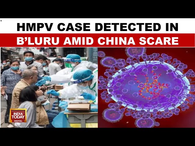 ⁣HMPV Virus News: Baby Detected With HMPV In Bengaluru Hospital, Karnataka Says Not Aware Of Strain