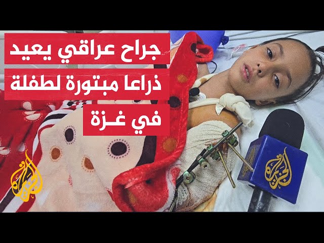 ⁣طلب إحضار الجزء المبتور من تحت الركام.. جراح عراقي متطوع يتمكن من إعادة زرع ذراع طفلة في غزة