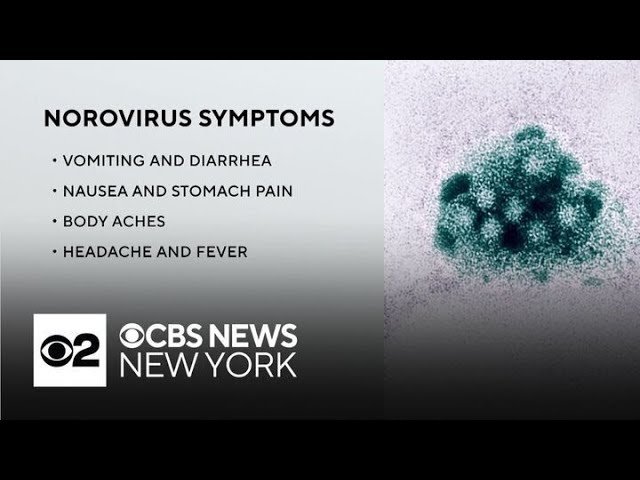 ⁣Nearly 1,300 cases of norovirus reported in NYC in December