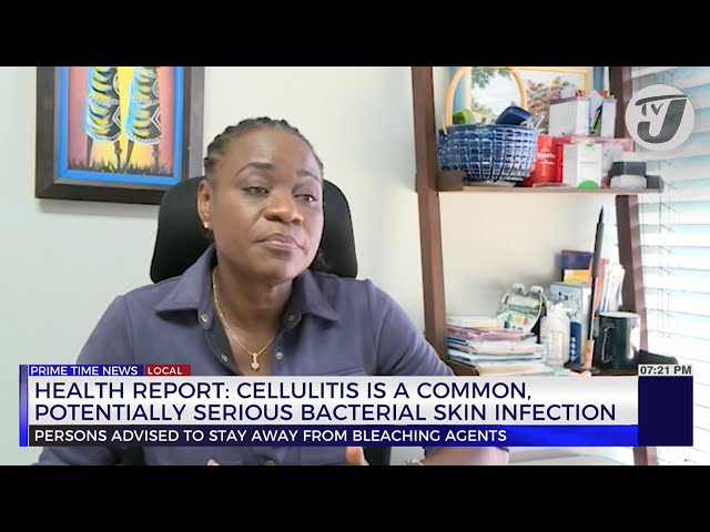 ⁣Health Report: Cellulitis is a Common, Potentially Serious Bacterial Skin Infection | TVJ News