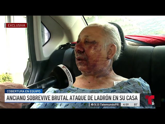 ⁣Una pesadilla: don William relata a Telenoticias brutal golpiza de ladrón