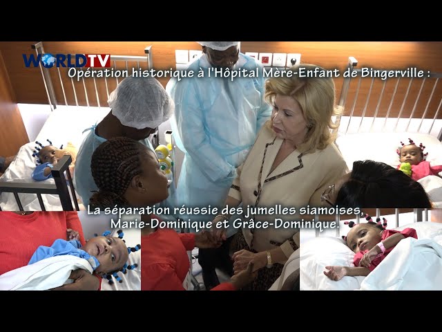 ⁣Côte d'Ivoire - La 1ère Dame, Dominique Ouattara visite les jumelles siamoises séparées avec su