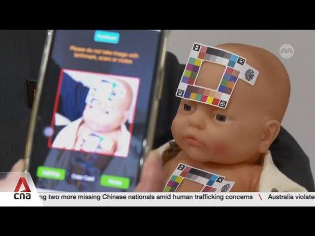 ⁣New app gets more accurate screening results for jaundice in infants