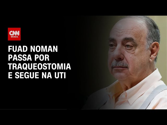 ⁣Fuad Noman passa por traqueostomia e segue na UTI | AGORA CNN