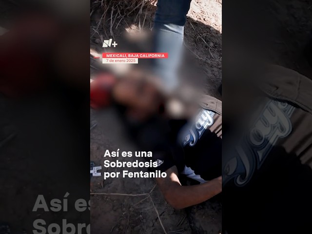 ⁣Así es una sobredosis por fentanilo: 'Sorullo' Se salvó gracias a la Naloxona - N+ #shorts